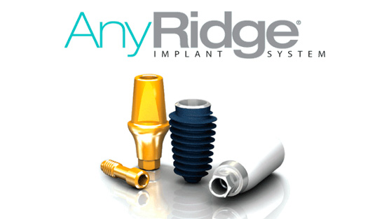 Implantes Dentales por AnyRidge™